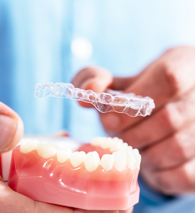 Clear Aligners in Indore