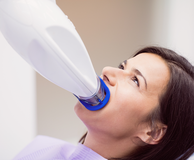 Teeth Bleaching Treatment in Indore