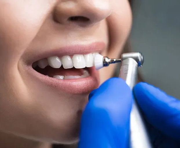 Teeth Cleaning and Polishing in Indore